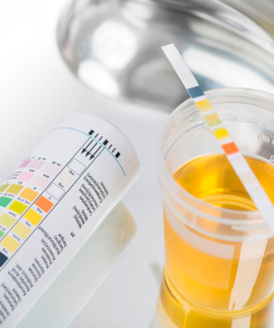 Xét nghiệm nước tiểu