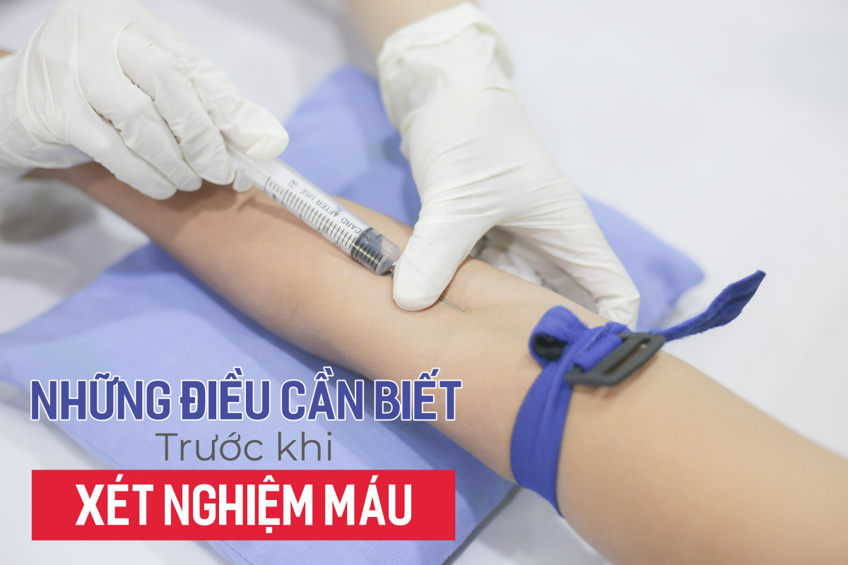 Những lưu ý khi đi xét nghiệm máu