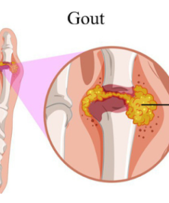 Định lượng Acid Uric (120-420 mmol/l)