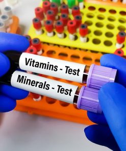 Xét nghiệm vi chất