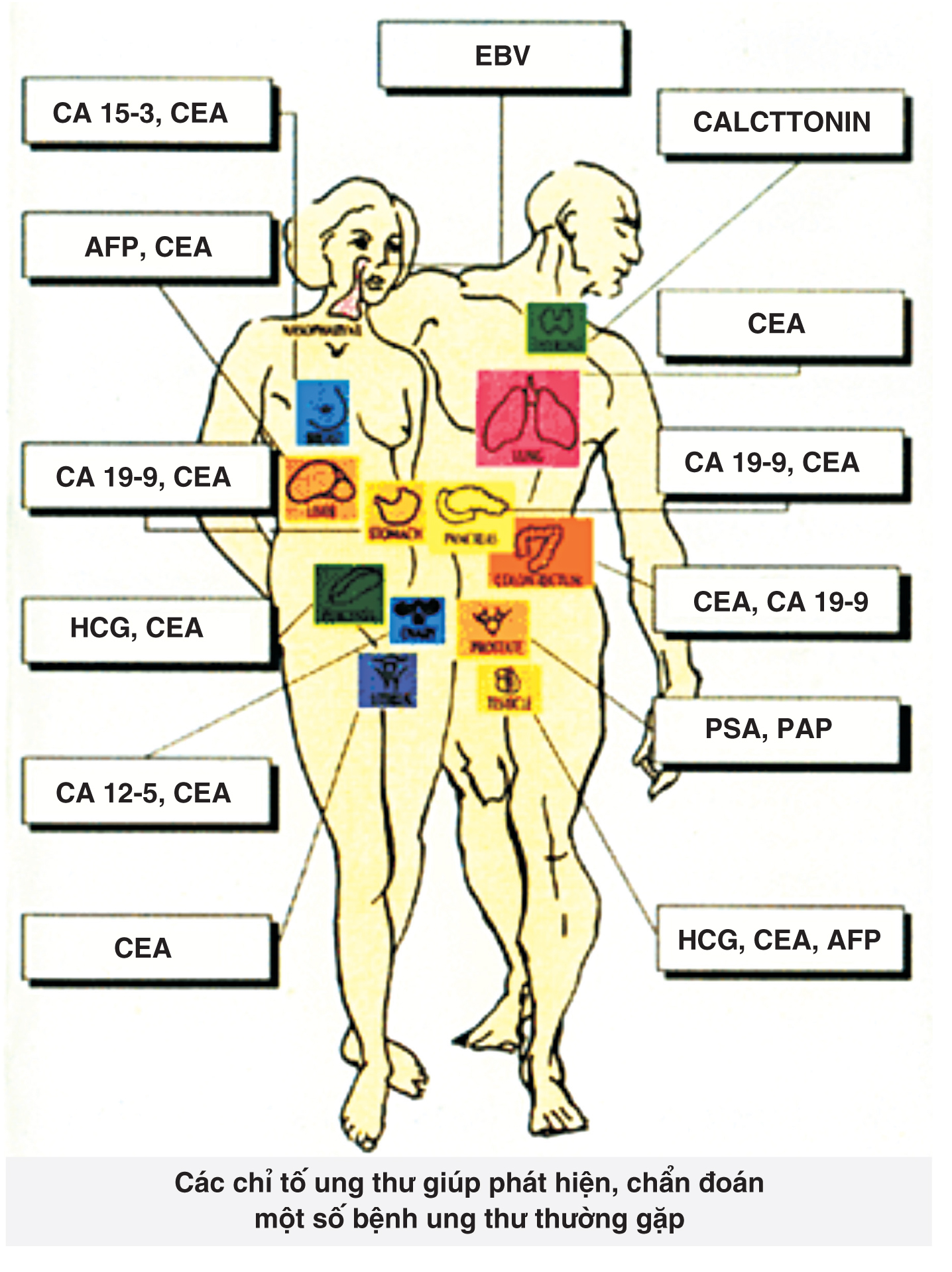 Marker ung thư – Ý nghĩa các chất chỉ điểm ung thư
