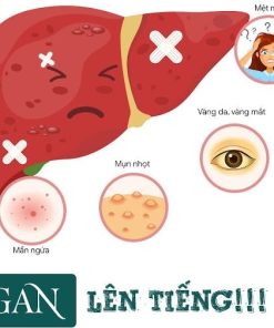 Định lượng ALT (GPT)  | 37 U/L