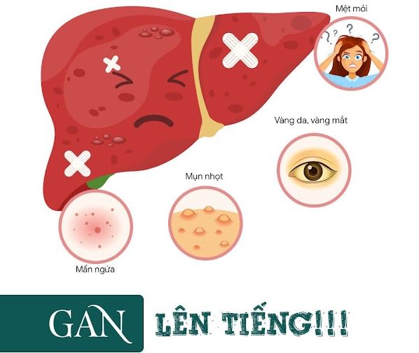 Định lượng ALT (GPT) | 37 U/L