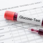 Định lượng Glucose | 3,9-6,4 mmol/l