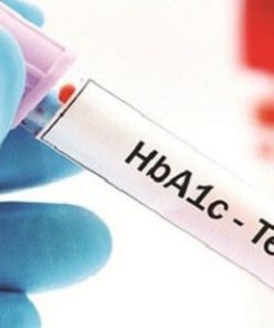 Xét nghiệm đường máu