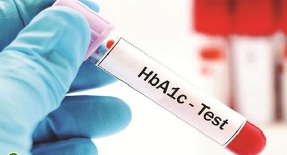 Các xét nghiệm tiểu đường