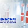 Định lượng Triglycerides | 0.5-2,3 mmol/l