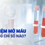 Định lượng Cholesterol | 3.9 - 5.2mmol/l