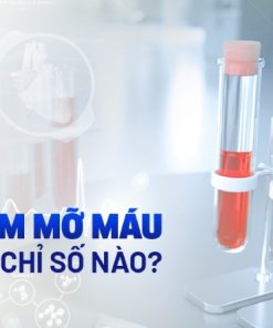 Định lượng Cholesterol | 3.9 - 5.2mmol/l