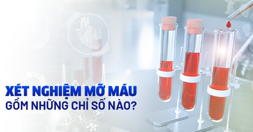 Định lượng Triglycerides | 0.5-2,3 mmol/l