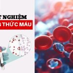 Xét nghiệm công thức máu 18 thông số