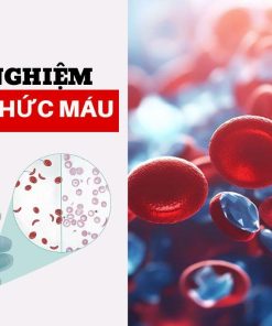 Xét nghiệm công thức máu 18 thông số