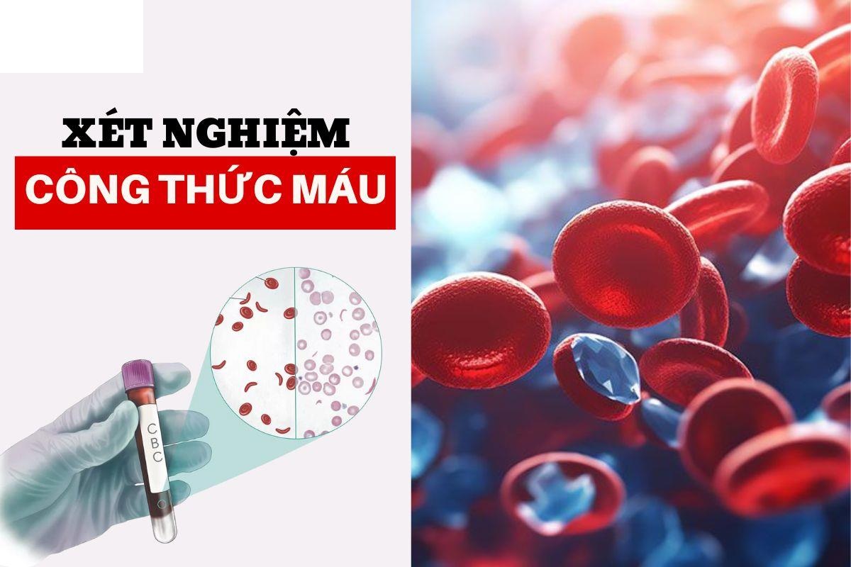 Xét nghiệm công thức máu 18 thông số
