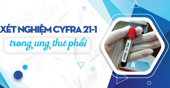Cyfra 21-1 Ung thư phổi (Cytokeratin 19 fragments)