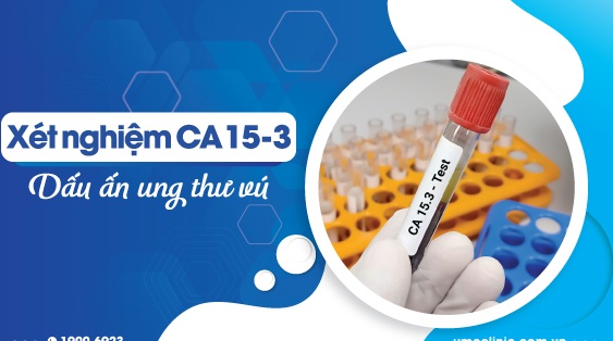 CA 15-3 (Cancer Antigen 15-3): Chất chỉ điểm đặc hiệu nhất đối với ung thư vú