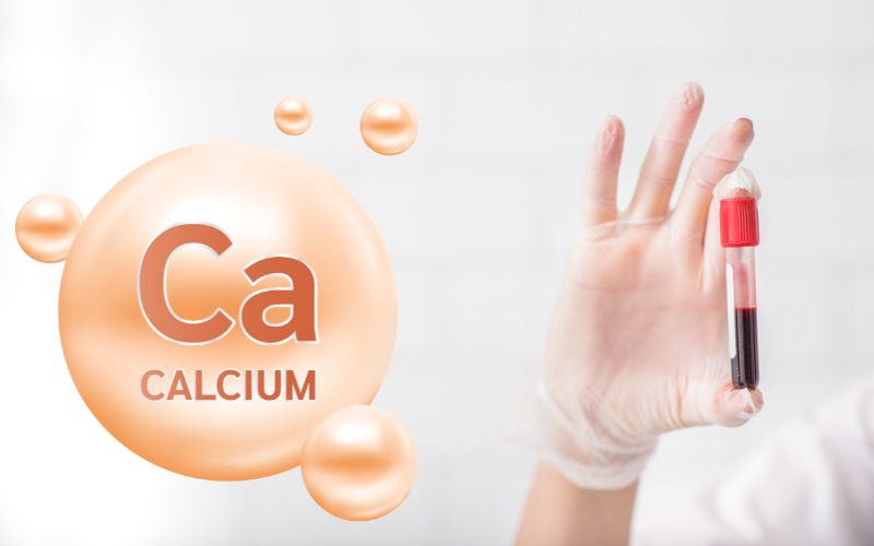 Xét nghiệm Calxi