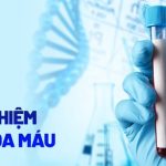 Định lượng Albumin | Người lớn:35-52 - Trẻ em: 28-45 g/dl