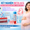 Xét nghiệm Beta hCG – Phát hiện thai sớm