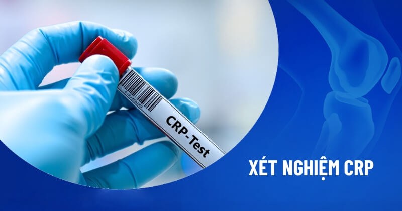 CRP định lượng